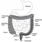 colonoscopy