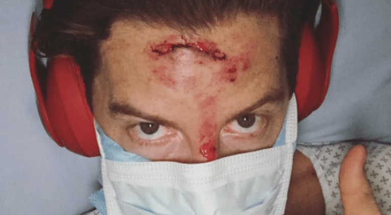 Snowboarder White’s crash lands him in hospital
